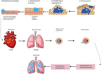 MicroRNAs, long non-coding RNAs, and circular RNAs and gynecological cancers: focus on metastasis